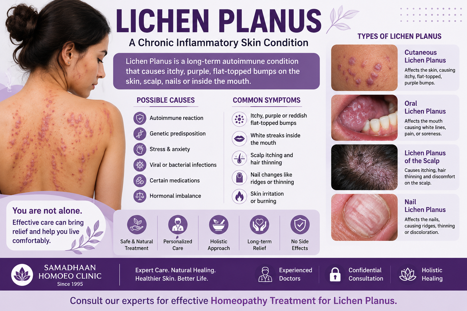 Homeopathy treatment for Lichen Planus in Lucknow with personalized skin care